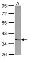 Ring Finger And CHY Zinc Finger Domain Containing 1 antibody, NBP2-19839, Novus Biologicals, Western Blot image 