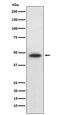 Wnt Family Member 5B antibody, M05836, Boster Biological Technology, Western Blot image 