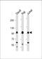 Mitogen-activated protein kinase kinase kinase kinase 1 antibody, M07909, Boster Biological Technology, Western Blot image 