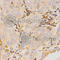 Kallikrein Related Peptidase 5 antibody, A2991, ABclonal Technology, Immunohistochemistry paraffin image 