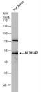 ALDH1A2 antibody, NBP2-15338, Novus Biologicals, Western Blot image 