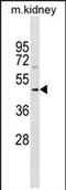 SDS3 Homolog, SIN3A Corepressor Complex Component antibody, PA5-72013, Invitrogen Antibodies, Western Blot image 