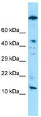 Testis-specific basic protein Y 1 antibody, TA338179, Origene, Western Blot image 