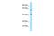 YY2 Transcription Factor antibody, PA5-45722, Invitrogen Antibodies, Western Blot image 