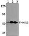 Threonine Synthase Like 2 antibody, PA5-75923, Invitrogen Antibodies, Western Blot image 