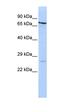 Proteasome Subunit Beta 4 antibody, orb330846, Biorbyt, Western Blot image 