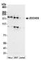 Terminal uridylyltransferase 7 antibody, A305-088A, Bethyl Labs, Western Blot image 