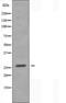 Lecithin Retinol Acyltransferase antibody, orb225622, Biorbyt, Western Blot image 