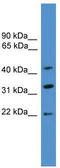 ADP Ribosylation Factor Interacting Protein 1 antibody, TA334957, Origene, Western Blot image 