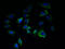 Transmembrane 7 Superfamily Member 3 antibody, A61334-100, Epigentek, Immunofluorescence image 