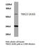 T-Box 22 antibody, LS-C176844, Lifespan Biosciences, Western Blot image 