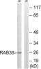 RAB38, Member RAS Oncogene Family antibody, LS-B9862, Lifespan Biosciences, Western Blot image 