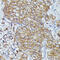Cortactin antibody, 15-851, ProSci, Immunohistochemistry paraffin image 