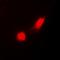 Proteasome 26S Subunit, ATPase 2 antibody, orb340806, Biorbyt, Immunofluorescence image 