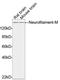 Neurofilament Medium antibody, LS-C203130, Lifespan Biosciences, Western Blot image 