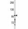 Proprotein Convertase Subtilisin/Kexin Type 5 antibody, F47688-0.4ML, NSJ Bioreagents, Western Blot image 