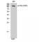 Protein Tyrosine Kinase 2 antibody, LS-C381125, Lifespan Biosciences, Western Blot image 