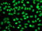 Fibroblast Growth Factor Receptor 2 antibody, LS-C172938, Lifespan Biosciences, Immunofluorescence image 