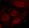 Histone Deacetylase 2 antibody, LS-C203029, Lifespan Biosciences, Immunofluorescence image 