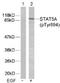 Signal Transducer And Activator Of Transcription 5A antibody, NB100-82219, Novus Biologicals, Western Blot image 