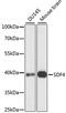 Stromal Cell Derived Factor 4 antibody, A15443, ABclonal Technology, Western Blot image 