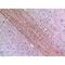 LYN Proto-Oncogene, Src Family Tyrosine Kinase antibody, LS-C387088, Lifespan Biosciences, Immunohistochemistry frozen image 