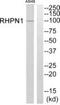 Rhophilin-1 antibody, PA5-39421, Invitrogen Antibodies, Western Blot image 