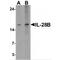 Interferon Lambda 3 antibody, MBS153650, MyBioSource, Western Blot image 