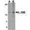 Interleukin-28B antibody, MBS153650, MyBioSource, Western Blot image 