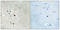 Fms Related Tyrosine Kinase 3 antibody, A00188Y969, Boster Biological Technology, Immunohistochemistry frozen image 