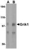 Glutamate Ionotropic Receptor Kainate Type Subunit 1 antibody, NBP1-76850, Novus Biologicals, Western Blot image 