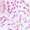 BRCA1 Associated RING Domain 1 antibody, LS-C353904, Lifespan Biosciences, Immunohistochemistry frozen image 