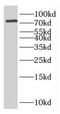 Glutamine-Fructose-6-Phosphate Transaminase 2 antibody, FNab03437, FineTest, Western Blot image 