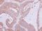 Nardilysin Convertase antibody, GTX114591, GeneTex, Immunohistochemistry paraffin image 