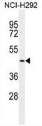 Transmembrane Serine Protease 11E antibody, AP54298PU-N, Origene, Western Blot image 