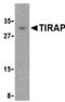 TIR Domain Containing Adaptor Protein antibody, orb108977, Biorbyt, Western Blot image 