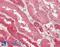 MER Proto-Oncogene, Tyrosine Kinase antibody, 43-529, ProSci, Enzyme Linked Immunosorbent Assay image 