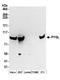 Glycogen Phosphorylase L antibody, A304-361A, Bethyl Labs, Western Blot image 