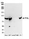 Glycogen phosphorylase, liver form antibody, A304-361A, Bethyl Labs, Western Blot image 