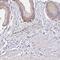 Arginine And Serine Rich Protein 1 antibody, NBP2-32411, Novus Biologicals, Immunohistochemistry frozen image 