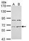 Activin A Receptor Type 2A antibody, NBP1-33601, Novus Biologicals, Western Blot image 