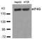 Eukaryotic Translation Initiation Factor 4 Gamma 1 antibody, AP08089PU-N, Origene, Western Blot image 