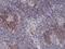 CD49D antibody, NBP2-61560, Novus Biologicals, Immunohistochemistry paraffin image 