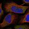 N-Acetylglucosamine Kinase antibody, PA5-57196, Invitrogen Antibodies, Immunofluorescence image 