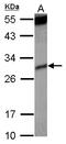 KKA3 antibody, LS-C155341, Lifespan Biosciences, Western Blot image 