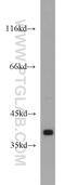 Protein Kinase C Alpha antibody, 55388-1-AP, Proteintech Group, Western Blot image 