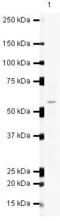 SET And MYND Domain Containing 1 antibody, PA5-19628, Invitrogen Antibodies, Western Blot image 