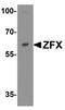 Zinc finger X-chromosomal protein antibody, A05947, Boster Biological Technology, Western Blot image 