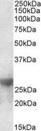 Galectin 3 antibody, LS-B9435, Lifespan Biosciences, Western Blot image 