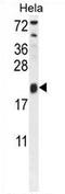 Trafficking Protein Particle Complex 3 antibody, AP54354PU-N, Origene, Western Blot image 